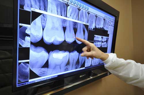 Modern Provo Dentist Office uses Digital X-Rays